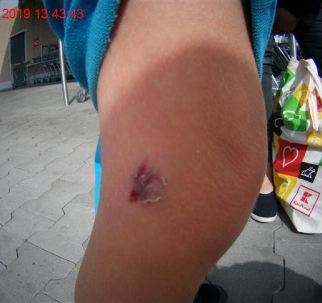 Strážnice ošetřila šestiletému chlapci krvácení